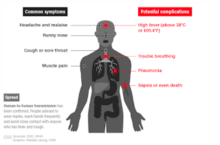 The basic and more severe symptoms of the new COVID-19 coronavirus