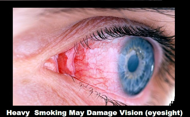  Heavy  Smoking May Damage Vision (eyesight)