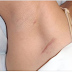 EARLY SIGNS THAT CANCER IS GROWING IN YOUR BODY