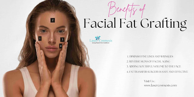 Benefits of Facial Fat Grafting