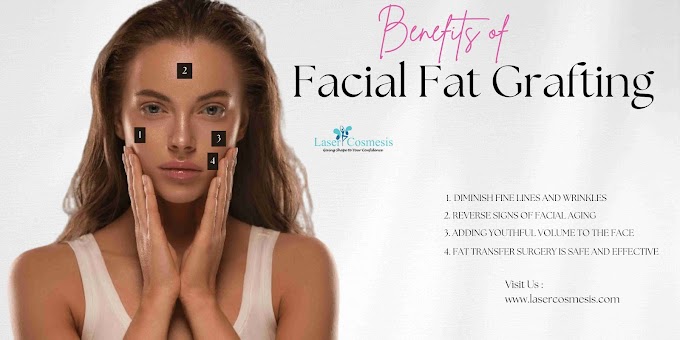 What Are the Benefits of Facial Fat Grafting?