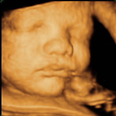 3d ultrasound scan. 3D ultrasounds. Ultrasound is