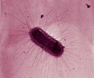 Enteropathogenik Escherichia coli (EPEC)