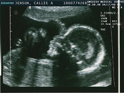 3d ultrasound pictures at 20 weeks. enjoyed every minute of 4d