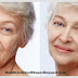 Remove Wrinkle On Face { Best Anti-Aging Secrets }