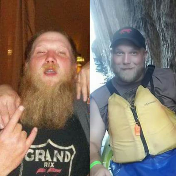 10+ Before-And-After Pics Show What Happens When You Stop Drinking - 11 Years Sober
