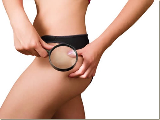 celulitis