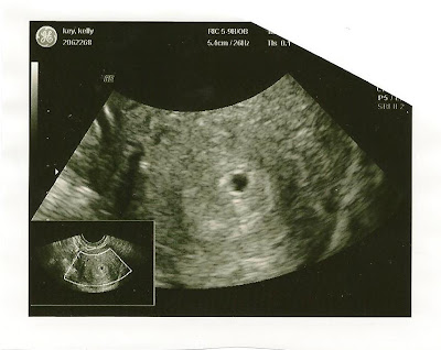 6 Weeks Pregnant1st Ultrasound!