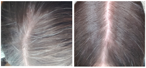 Melaniq grey hair before and after