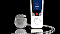 Boston Scientific Spinal Cord Stimulator Side Effects Science