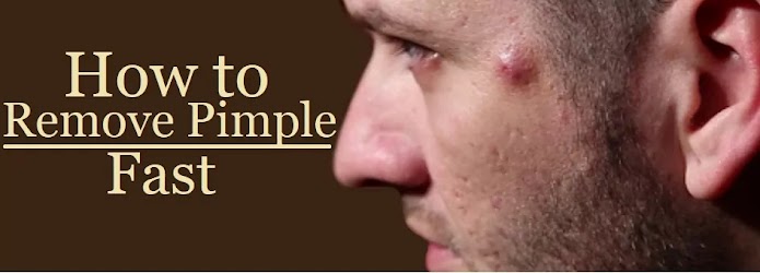 How to remove pimple permanently