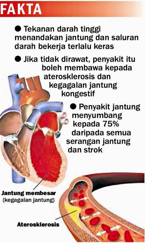 Sweet memories: 7 Langkah Kurangkan Tekanan Darah Tinggi