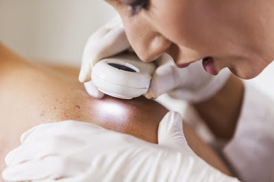 الجلد دكتور جلدية فحص سرطان skin cancer doctor examin