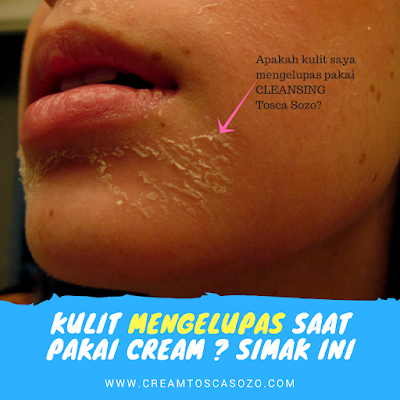 cream pemutih wajah yang tidak mengelupas cleansing tosca sozo