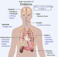 gambar organ tubuh diabetes melitus insipidus