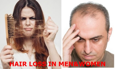 hair loss