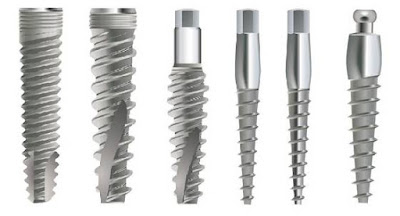 Thời điểm thích hợp để cấy ghép Implant