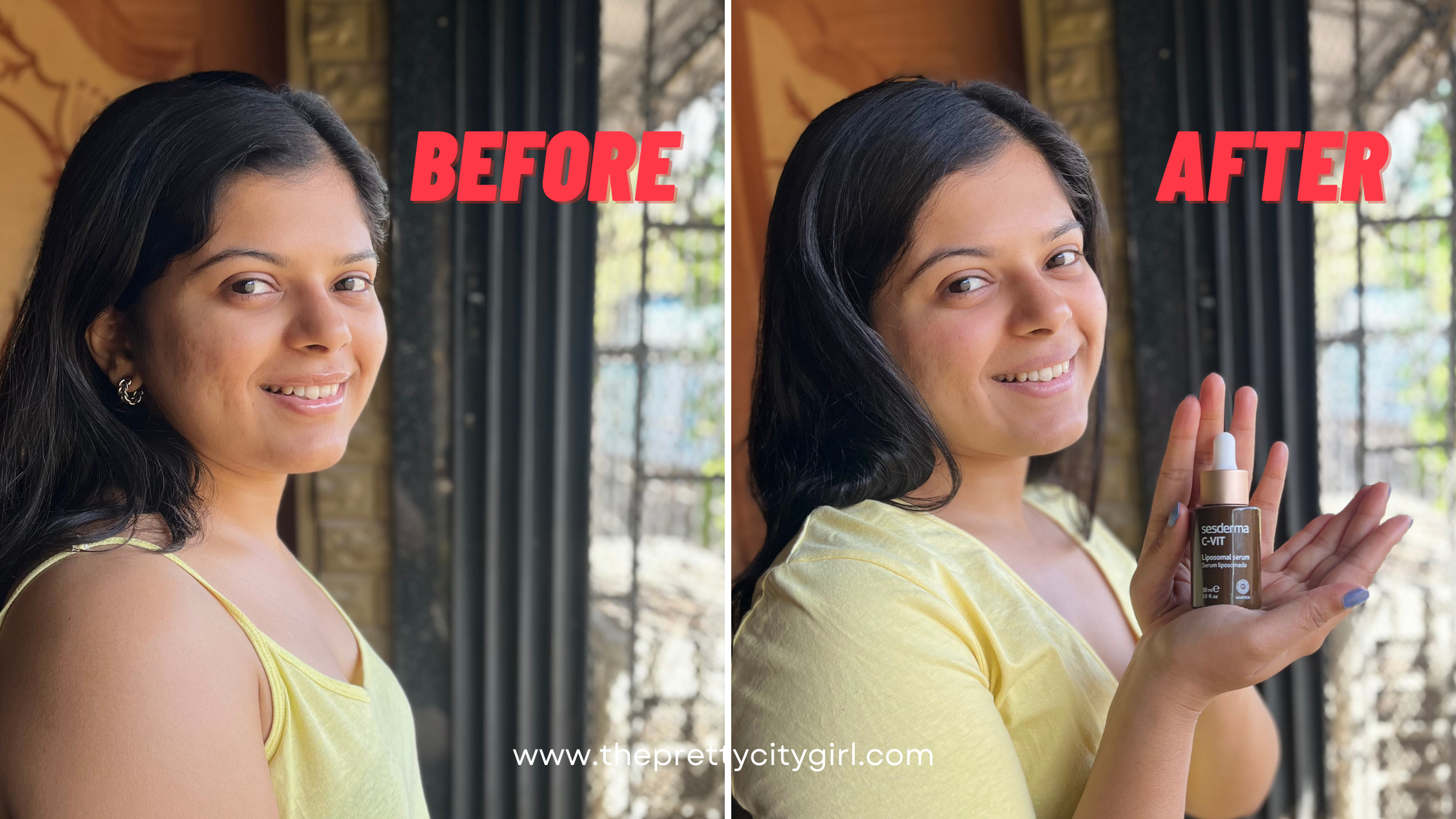 My with Vitamin C Serums - City Girl | Indian Travel & Lifestyle Blog