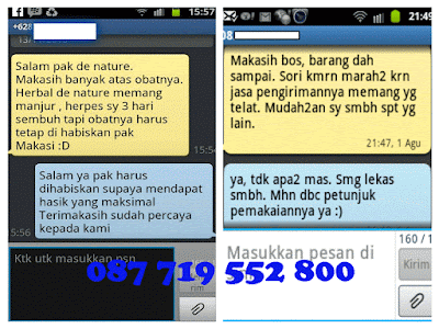 testimoni penyakit herpes