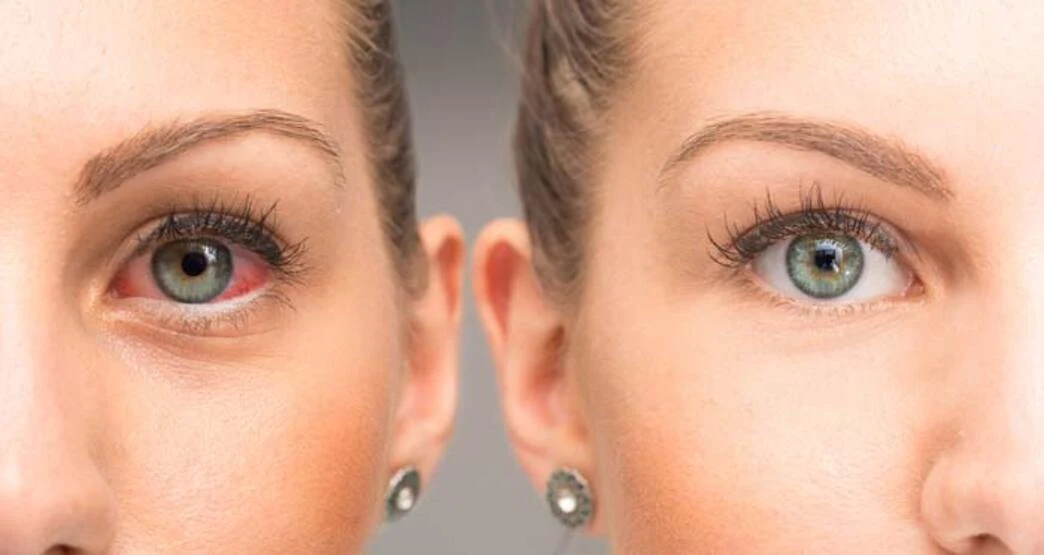Göz ağrılarınızın nedeni bu sorunlar olabilir