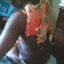 Shocking Pic: Custom Officer Attack Woman With Acid