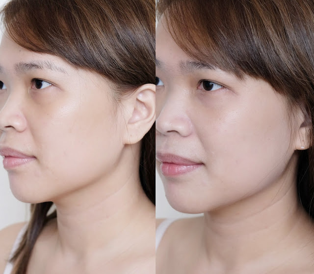 before and after photo of Esfolio Snow Whitening Cream Review by Nikki Tiu of www.askmewhats.com