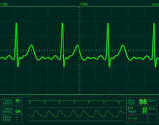 ﻿Elektrokardiyografi (EKG)