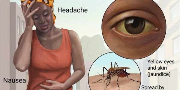 Nine killed as yellow fever hits 16 states