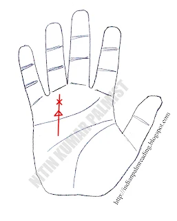 Cross & Triangle On Sun Line On Hand In Palmistry