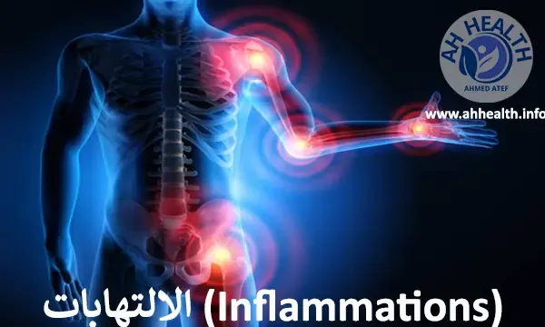 الالتهابات (Inflammations)