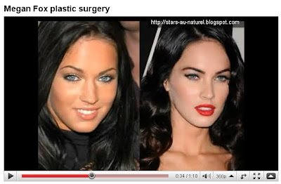 megan fox surgery