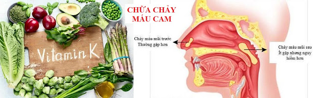 RAU XANH CHỮA BỆNH THÔNG THƯỜNG - CHẢY MÁU CAM