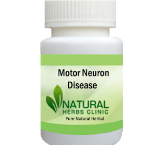 Herbal Product for Motor Neuron Disease