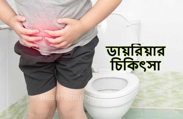ডায়রিয়া (Diarrhea) কি? ডায়রিয়ার কারণ, লক্ষণ ও চিকিৎসা 