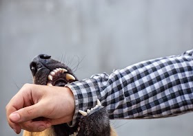 Animal Bite Injury Lawyer in Glendale, Arizona: Protecting Your Rights and Seeking Compensation