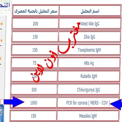 تعرف علي سعر تحليل فيروس كورونا