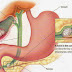 Gallbladder ( पित्त की थेली) की पत्थरी निकालने का प्राकृतिक उपचार:-