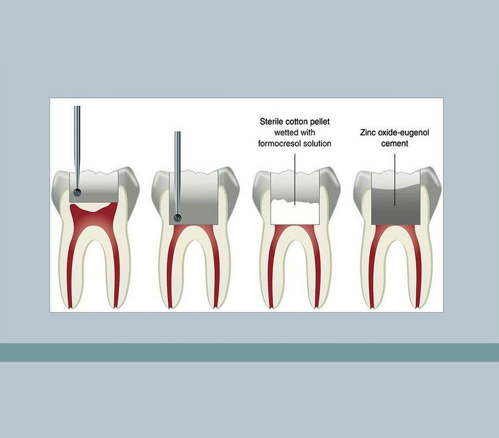 Endodontics