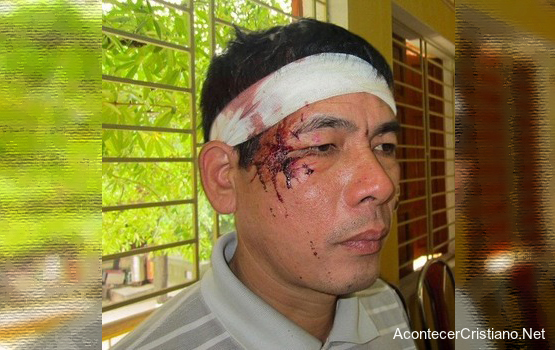 Pastor golpeado por realizar cultos en iglesia