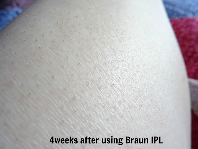 Braun Silk-expert IPL