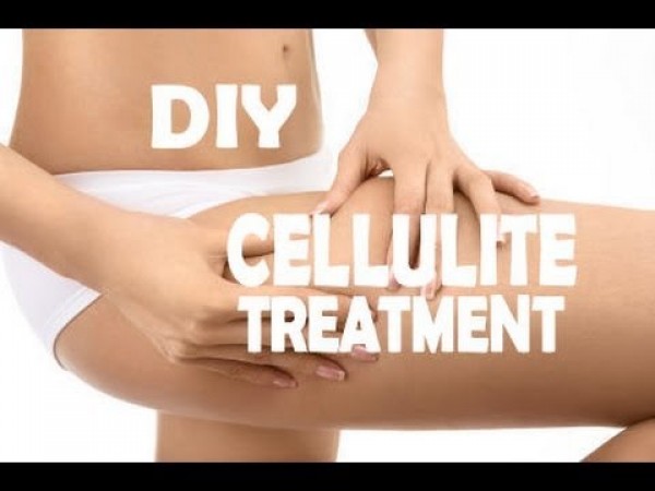 Cellulite treatment - home remedies for cellulite