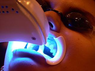 Teeth Whitening in Poland