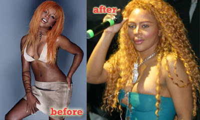 Lil Kim Before After