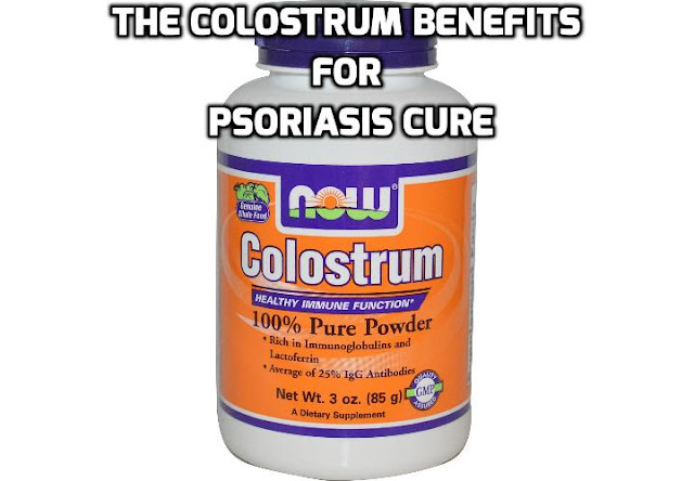 If you are looking for natural cures or some way to control the outbreaks and the symptoms associated psoriasis, read on to learn about the colostrum benefits in helping you to achieve this.