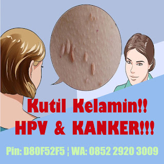 Obat Kutil Kelamin