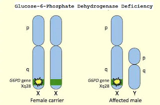 Glucose-6-Phosphate Dehydrogenase Deficiency (G6PDD)