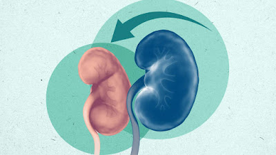 Can kidney damage be reversed?