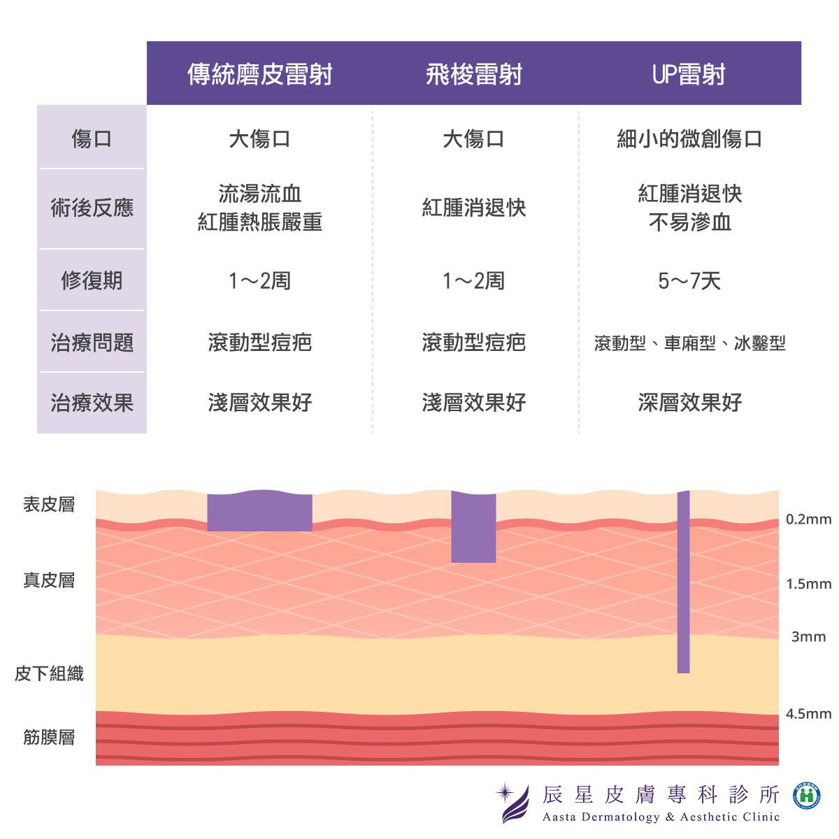 UP雷射效果