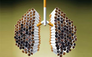 Lung Cancer