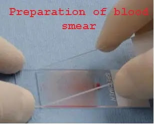 Preparation of blood smear (Blood Film)